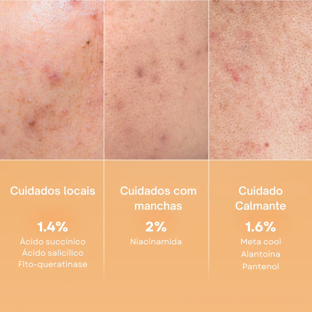 Discos de Ácido Succínico com Pantenol