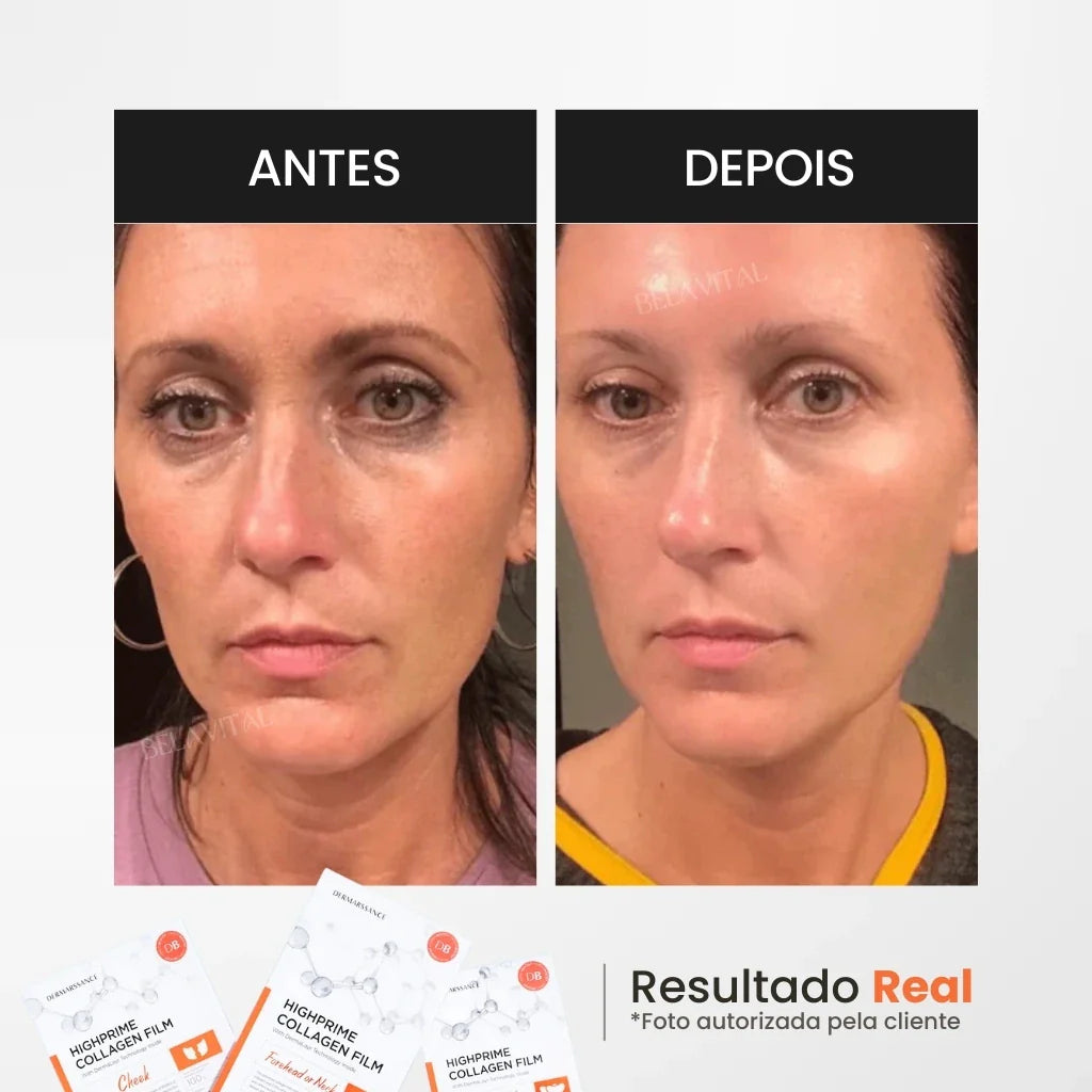 Kit Máscara de Colágeno GoldBotox Highprime: Renovação Profunda da Pele