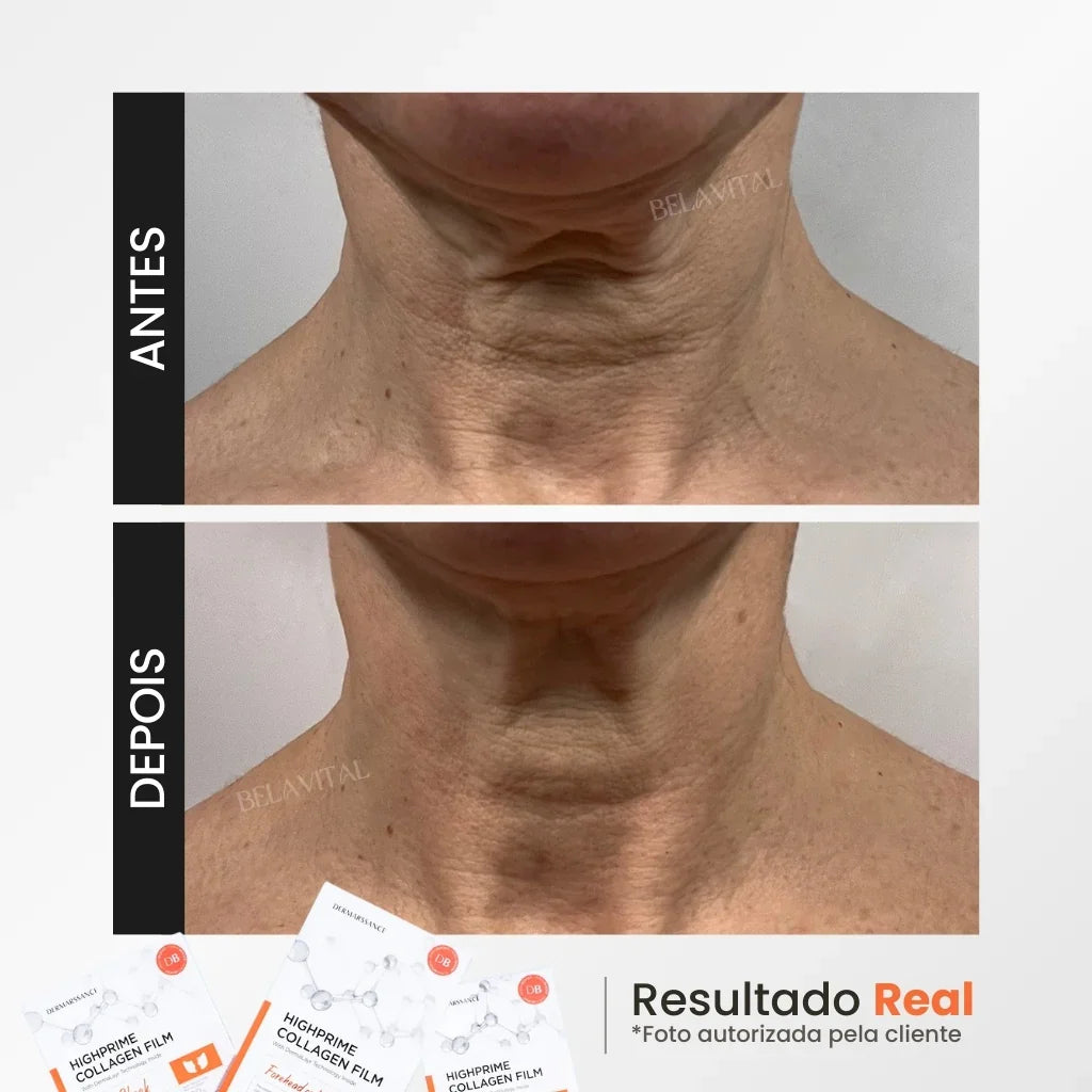 Kit Máscara de Colágeno GoldBotox Highprime: Renovação Profunda da Pele