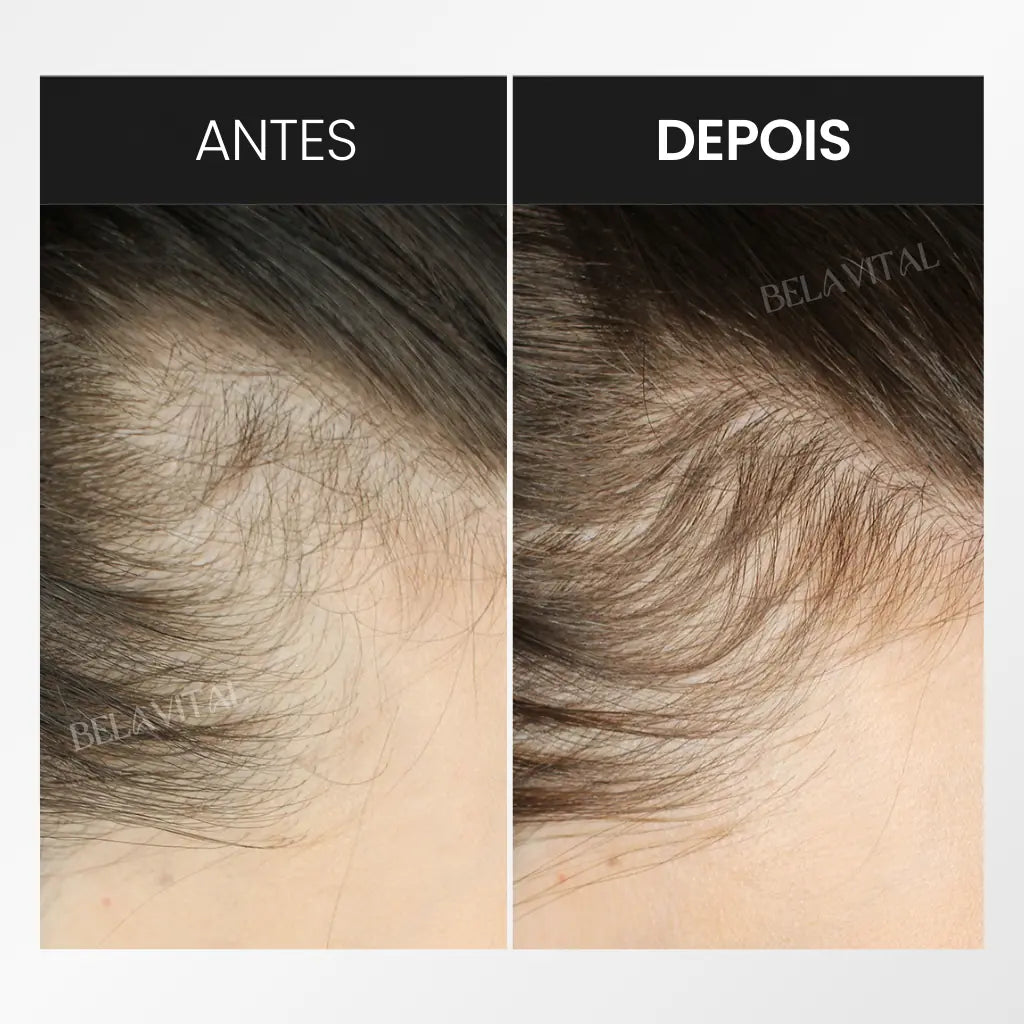 Kit Hair: Fortalece e Cresce