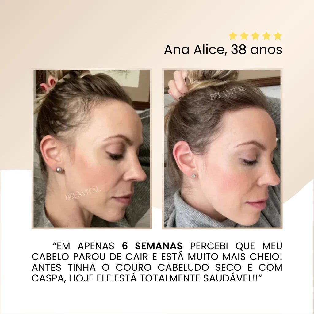 Repair Hair Therapy: Tratamento Antiquedas 3 em 1