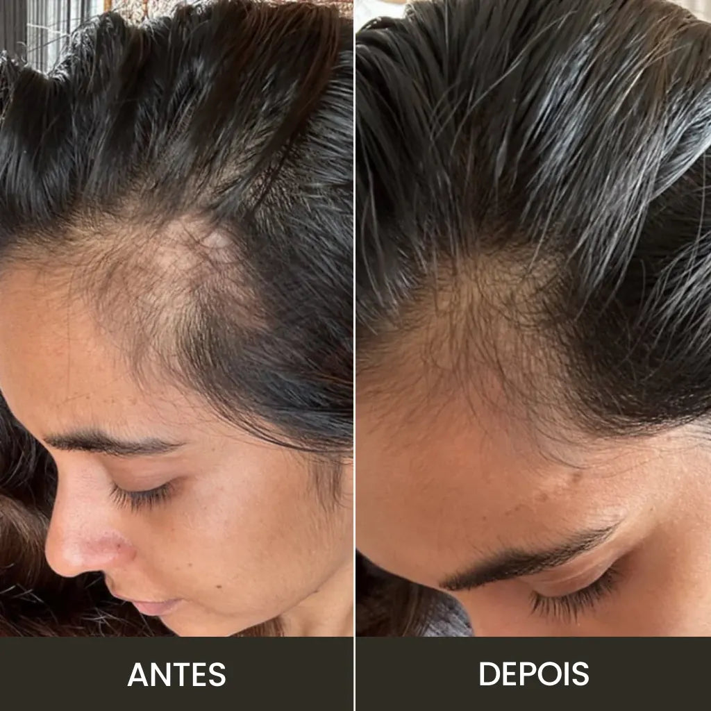 Massageador Elétrico para Couro Cabeludo | Crescimento e Nutrição Natural