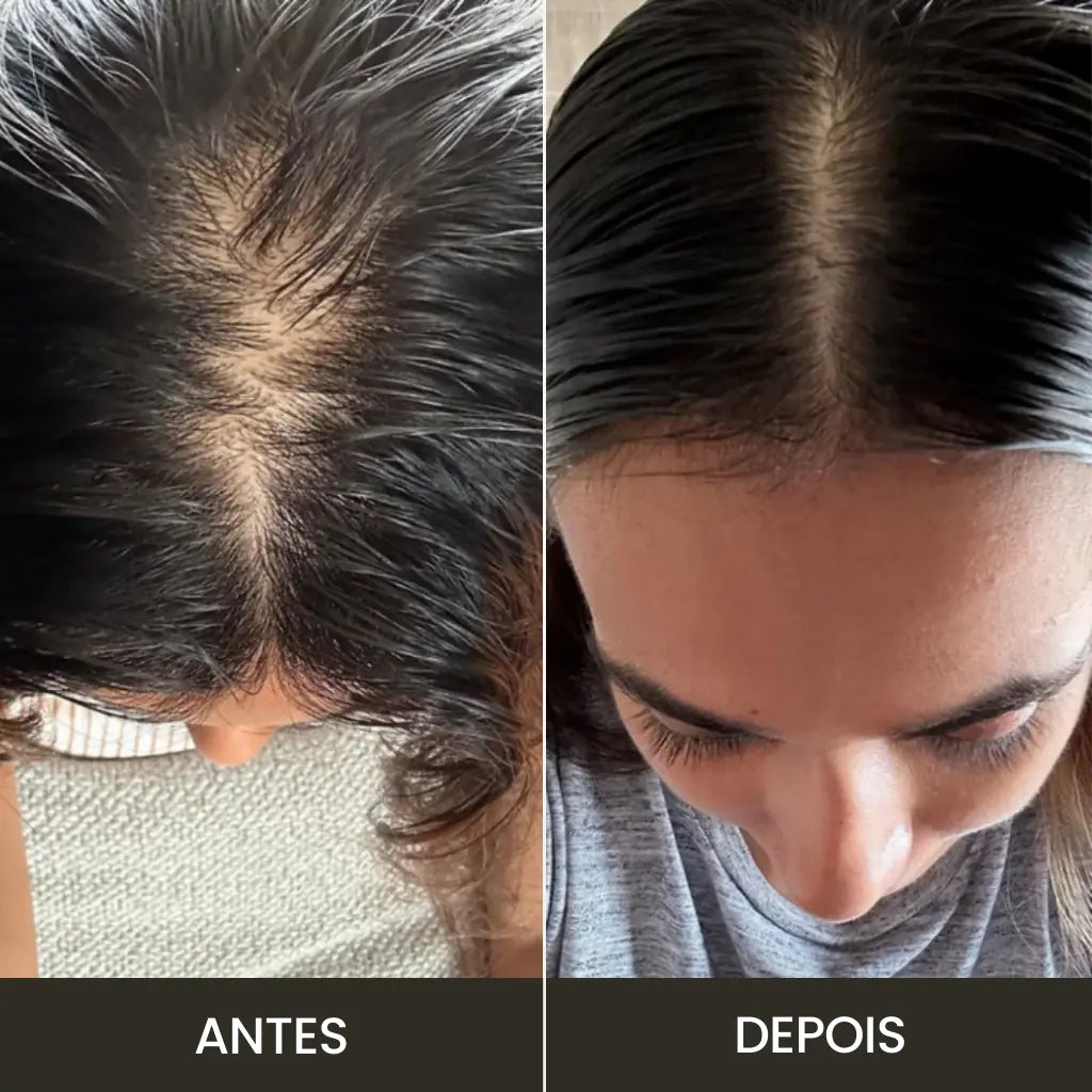 Massageador Elétrico para Couro Cabeludo | Crescimento e Nutrição Natural