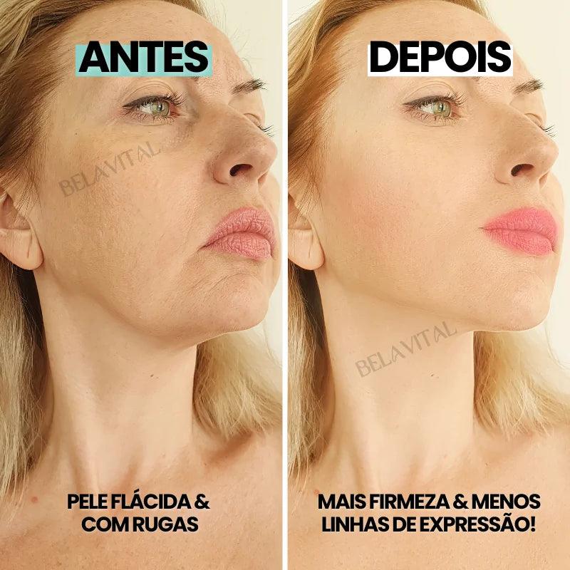 DermaRoller: Pele, Cabelo e Barba em 1 só produto