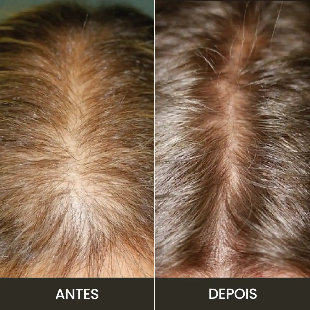 Óleo Essencial de Alecrim: Crescimento e Fortalecimento Capilar