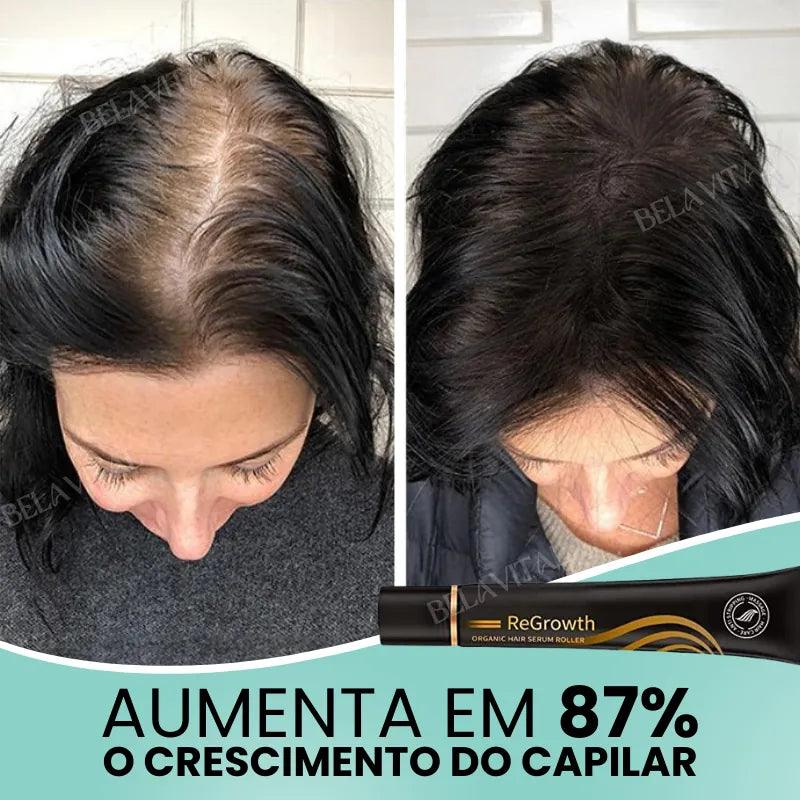 Repair Hair®: 95% Menos Queda 20x Mais Crescimento | Compre 1, Leve 2