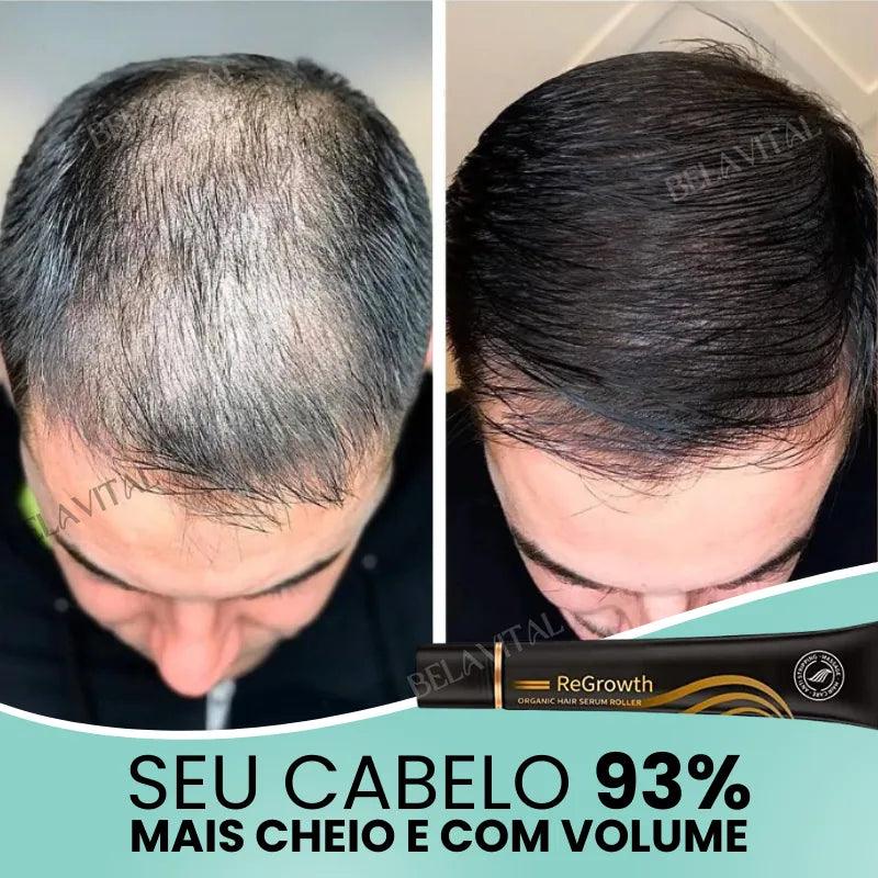 Repair Hair®: 95% Menos Queda 20x Mais Crescimento | Compre 1, Leve 2