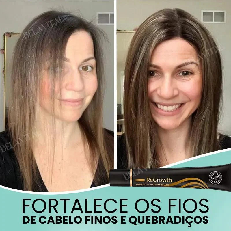 Repair Hair®: 95% Menos Queda 20x Mais Crescimento | Compre 1, Leve 2