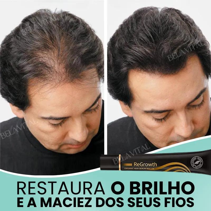 Repair Hair®: 95% Menos Queda 20x Mais Crescimento | Compre 1, Leve 2