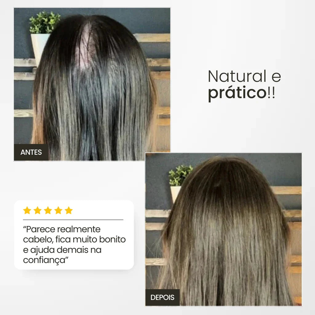 Top Closure - Topo de Cabelo Natural com Franja 45cm | Para Alopecia e Falhas