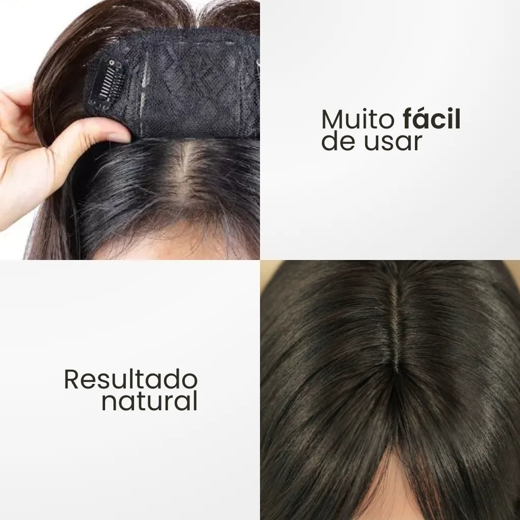 Top Closure - Topo de Cabelo Natural com Franja 45cm | Para Alopecia e Falhas