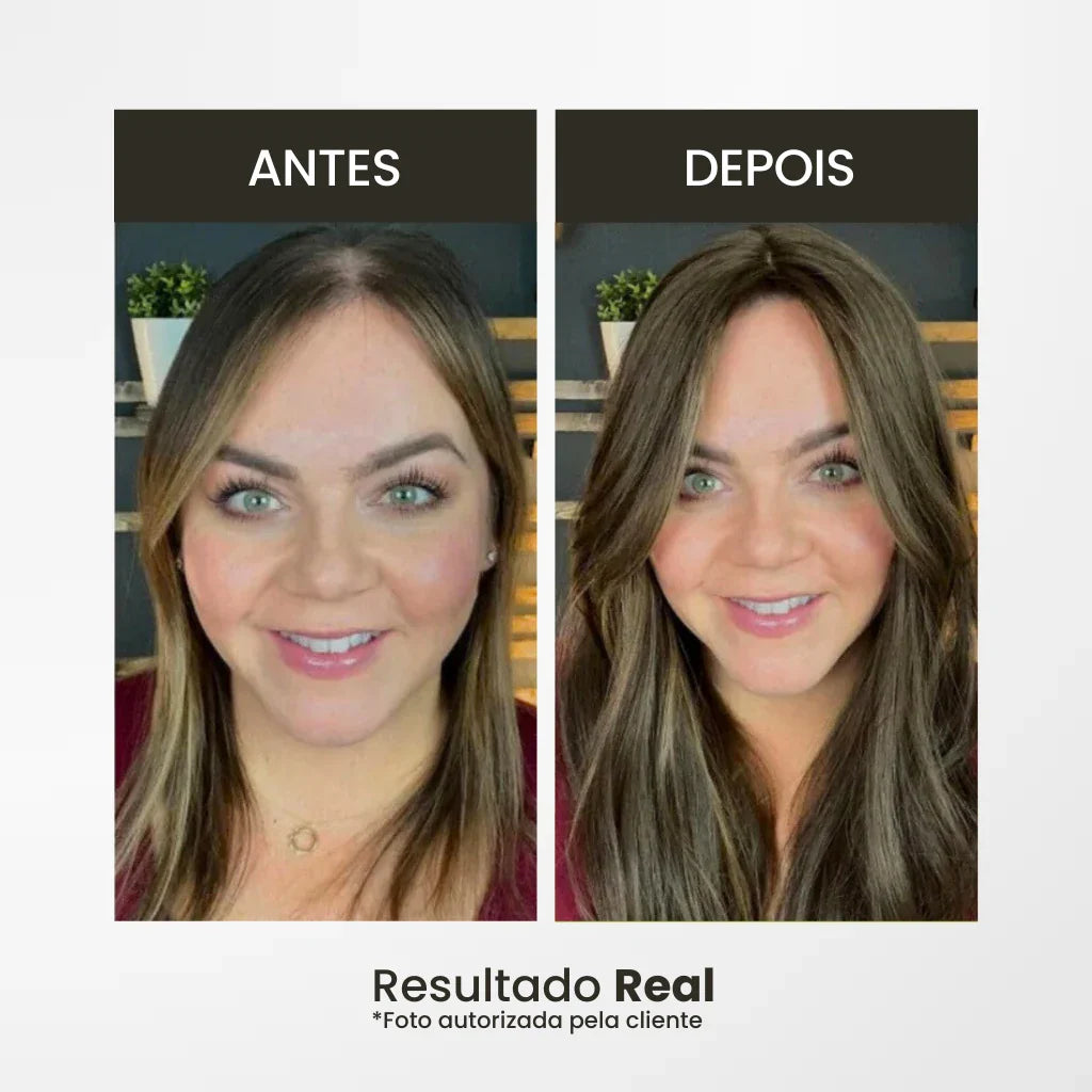 Top Closure - Topo de Cabelo Natural com Franja 45cm | Para Alopecia e Falhas