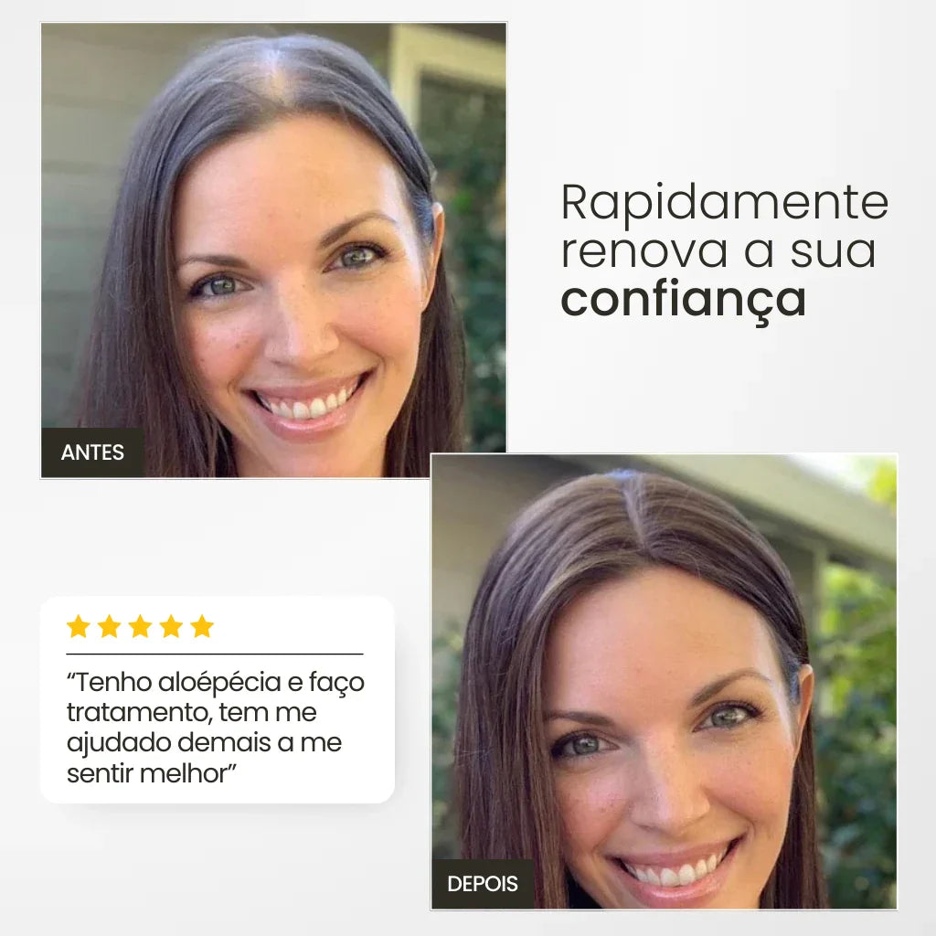 Top Closure - Topo de Cabelo Natural com Franja 45cm | Para Alopecia e Falhas