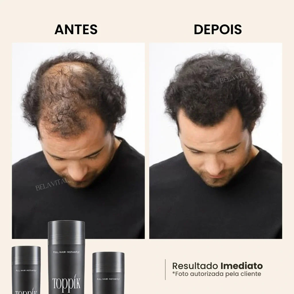 Toppik Hair: Fibra Capilar para Cobertura Instantânea