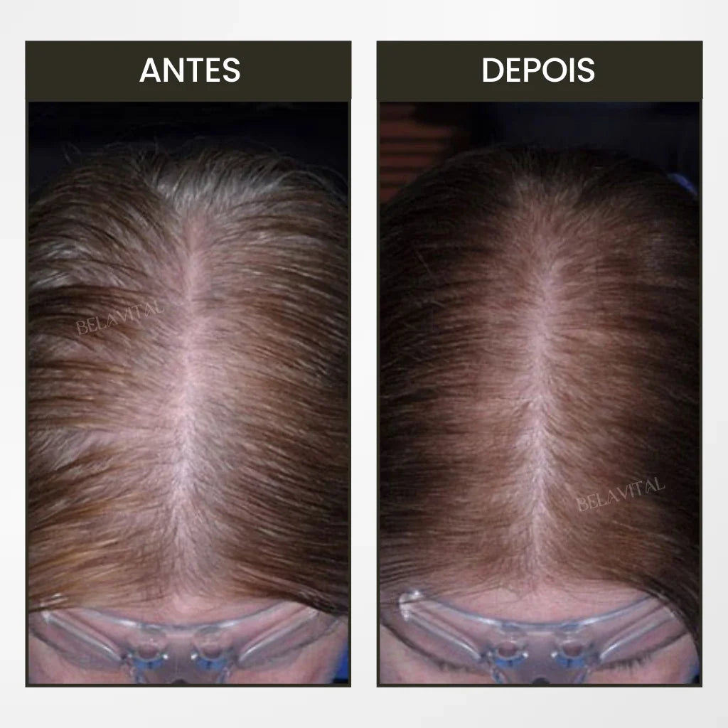 Pente BreoBrush: Terapia de Luz, Massageador e Difusor