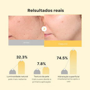 Máscara Jelly Dourada com Ácido Kójico e Cúrcuma - Kit com 4