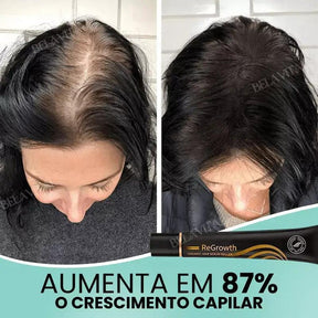 Kit Repair Hair Pro+ com Brinde Exclusivo: O Tratamento Mais Completo Contra Queda de Cabelo e a Calvície!
