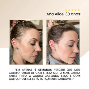 Repair Hair Therapy: Tratamento Antiquedas 3 em 1