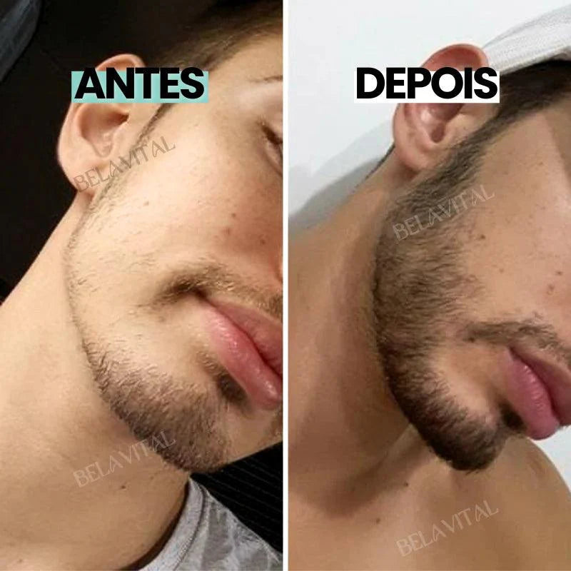 DermaRoller: Pele, Cabelo e Barba em 1 só produto