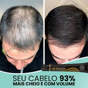 Repair Hair®: 95% Menos Queda 20x Mais Crescimento | Compre 1, Leve 2