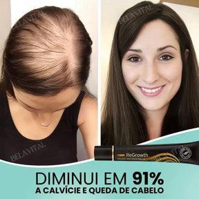 Repair Hair®: 95% Menos Queda 20x Mais Crescimento | Compre 1, Leve 2