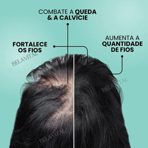 Repair Hair®: 95% Menos Queda 20x Mais Crescimento | Compre 1, Leve 2